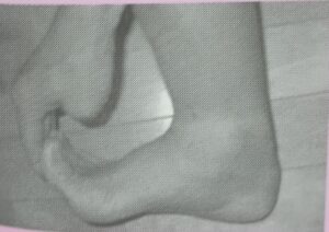 足底ストレッチ
