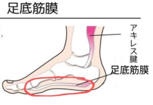 足底筋膜